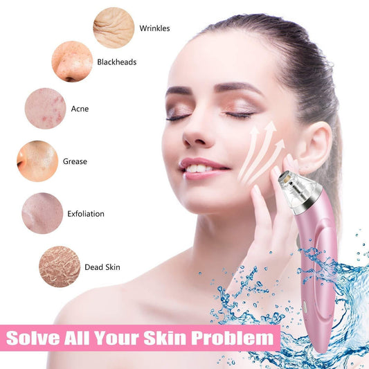 Vacuum Blackhead Remover | Rechargeable Pore Cleaner
“Pores Clear. Confidence High.” ✨